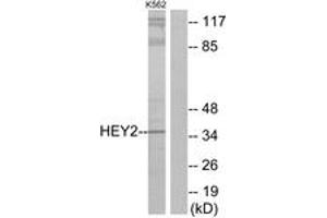 Western Blotting (WB) image for anti-Hairy/enhancer-of-Split Related with YRPW Motif 2 (HEY2) (AA 21-70) antibody (ABIN2889788) (HEY2 antibody  (AA 21-70))