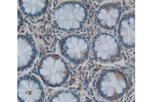 Used in DAB staining on fromalin fixed paraffin- embedded rectum tissue (Acyp2 antibody  (AA 2-99))