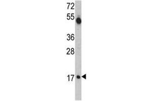 Western blot analysis of UBE2V1 antibody and mouse cerebellum tissue lysate. (UBE2V1 antibody  (AA 113-145))