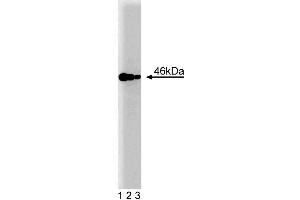 Western blot analysis of IAK1 on a Jurkat cell lysate (Human T-cell leukemia, ATCC TIB-152). (Aurora A antibody  (AA 8-116))