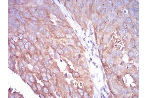 Immunohistochemistry (IHC) image for anti-Tubulin, beta 1 (TUBB1) (AA 33-166) antibody (ABIN5879491) (TUBB1 antibody  (AA 33-166))