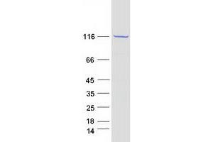 PC Protein (Transcript Variant 1) (Myc-DYKDDDDK Tag)