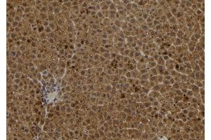 ABIN6278237 at 1/100 staining Rat liver tissue by IHC-P. (S100A2 antibody)