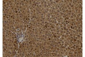 ABIN6278237 at 1/100 staining Rat liver tissue by IHC-P. (S100A2 antibody)
