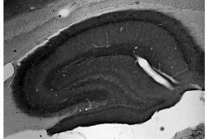 Adult rat hippocampus immunohistochemistry.