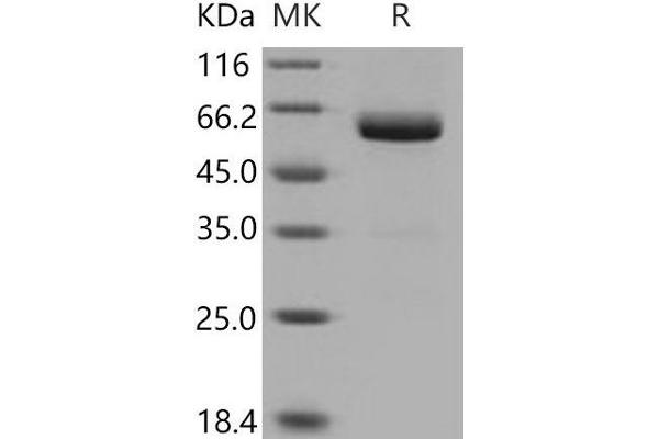 VSIG4 Protein (His tag,Fc Tag)