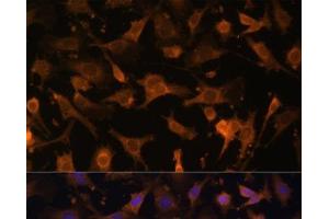 Immunofluorescence analysis of C6 cells using UFC1 Polyclonal Antibody at dilution of 1:100 (40x lens). (UFC1 antibody)