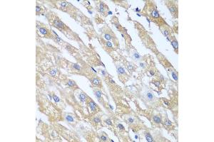 Immunohistochemistry of paraffin-embedded human liver using PPP4R1 antibody (ABIN5974671) at dilution of 1/100 (40x lens). (PPP4R1 antibody)