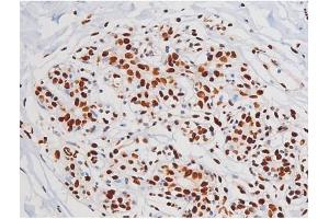 ABIN6267365 at 1/200 staining Human heart tissue sections by IHC-P.