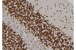 ABIN6263445 and ABIN6276995 at 1/100 staining Rat brain tissue by IHC-P.