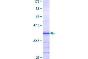 PKD2 Protein (AA 261-360) (GST tag)