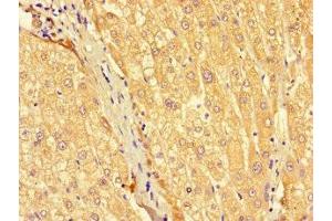 Immunohistochemistry of paraffin-embedded human liver tissue using ABIN7175490 at dilution of 1:100 (SEC22A antibody  (AA 10-187))