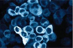 Immunofluorescent staining of A431 cells with c-Raf-1 antibody. (C-Raf-1 (AA 162-378) antibody)