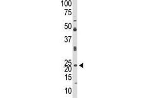 Image no. 1 for anti-Neurogenin 1 (NEUROG1) (N-Term) antibody (ABIN357407) (Neurogenin 1 antibody  (N-Term))