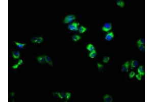 Immunofluorescence staining of PC-3 cells with ABIN7167298 at 1:166, counter-stained with DAPI.