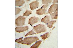 Formalin-fixed and paraffin-embedded human skeletal muscle reacted with ARPC1A Antibody (C-term), which was peroxidase-conjugated to the secondary antibody, followed by DAB staining. (ARPC1A antibody  (C-Term))