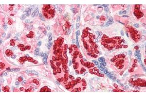 Detection of HBa1 in Human Erythrocytes of Placenta Tissue using Polyclonal Antibody to Hemoglobin Alpha 1 (HBa1) (HBA1 antibody  (AA 1-142))