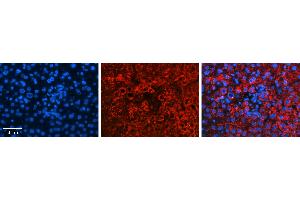 Rabbit Anti-GLYAT Antibody   Formalin Fixed Paraffin Embedded Tissue: Human Liver Tissue Observed Staining: Cytoplasm in hepatocytes Primary Antibody Concentration: 1:100 Other Working Concentrations: N/A Secondary Antibody: Donkey anti-Rabbit-Cy3 Secondary Antibody Concentration: 1:200 Magnification: 20X Exposure Time: 0. (GLYAT antibody  (N-Term))