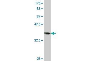 Western Blot detection against Immunogen (36. (RAD18 antibody  (AA 332-430))