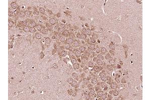 Paraformaldehyde-fixed, paraffin embedded Mouse brain Antigen retrieval by boiling in sodium citrate buffer (pH6. (IL6RA antibody  (AA 351-460))