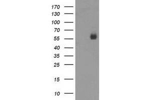 HEK293T cells were transfected with the pCMV6-ENTRY control (Left lane) or pCMV6-ENTRY PVRL1 (Right lane) cDNA for 48 hrs and lysed. (PVRL1 antibody)