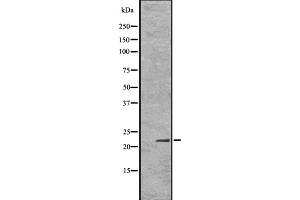 Western blot analysis Id1 using Jurkat whole cell lysates (ID1 antibody  (Internal Region))