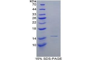 SDS-PAGE of Protein Standard from the Kit (Highly purified E. (Complement Factor B ELISA Kit)