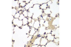 Immunohistochemistry of paraffin-embedded mouse lung using ESR2 antibody (ABIN5971372) at dilution of 1/200 (40x lens). (ESR2 antibody)