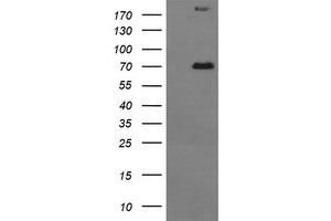 Image no. 4 for anti-Tumor Protein P73 (TP73) (AA 167-409) antibody (ABIN1491006) (Tumor Protein p73 antibody  (AA 167-409))