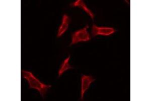 ABIN6275706 staining Hela by IF/ICC. (ZP4 antibody  (Internal Region))