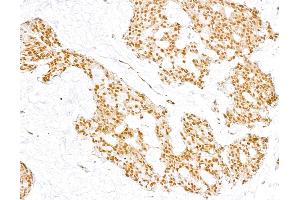 Immunohistochemistry (IHC) image for anti-Coactivator-Associated Arginine Methyltransferase 1 (CARM1) (C-Term) antibody (ABIN7454627) (CARM1 antibody  (C-Term))