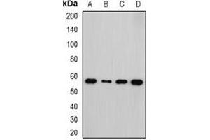 Western blot analysis of NEK3 expression in HepG2 (A), Hela (B), mouse kidney (C), rat brain (D) whole cell lysates. (NEK3 antibody)