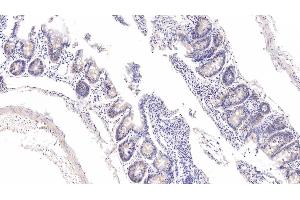 Detection of FXR in Rat Colon Tissue using Polyclonal Antibody to Farnesoid X Receptor (FXR) (NR1H4 antibody  (AA 375-568))