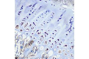 Immunohistochemistry of paraffin-embedded mouse bone marrow using Aggrecan Rabbit mAb (ABIN7265514) at dilution of 1:100 (40x lens). (Aggrecan antibody)