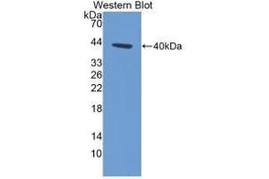 Western blot analysis of recombinant Human KRT14.