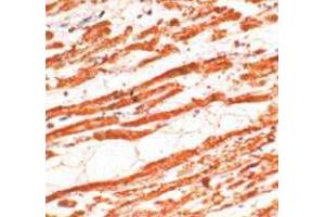 Immunohistochemical staining of human cardiac muscle stained with TNNT2 polyclonal antibody  at 1 : 50 for 10 min at RT. (Cardiac Troponin T2 antibody)