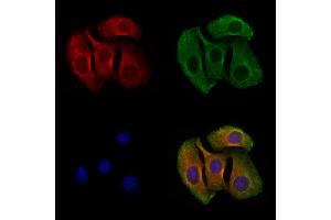 ABIN6258210 and ABIN6273865 staining Hela cells by IF/ICC.