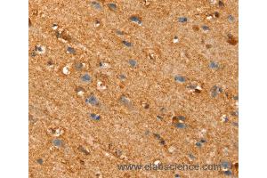 Immunohistochemistry of Human brain using SLC25A4 Polyclonal Antibody at dilution of 1:30