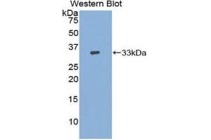 Western Blotting (WB) image for anti-Adenylate Cyclase 9 (ADCY9) (AA 1029-1282) antibody (ABIN3206678) (ADCY9 antibody  (AA 1029-1282))