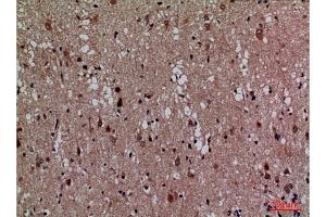 Immunohistochemical analysis of paraffin-embedded human brain, antibody was diluted at 1:100. (CDK4 antibody  (N-Term))