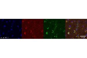 Immunohistochemistry (IHC) image for anti-PDZ and LIM Domain 5 (PDLIM5) antibody (ABIN7456030) (PDLIM5 antibody)
