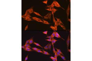 Immunofluorescence analysis of NIH-3T3 cells using PIK3C3/VPS34 Rabbit mAb (ABIN7269328) at dilution of 1:100 (40x lens). (PIK3C3 antibody)