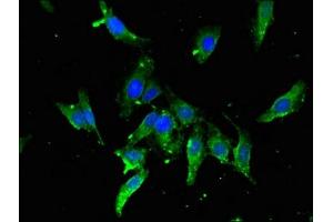 Immunofluorescent analysis of Hela cells using ABIN7171581 at dilution of 1:100 and Alexa Fluor 488-congugated AffiniPure Goat Anti-Rabbit IgG(H+L) (TBP antibody  (AA 1-55))