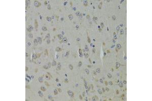 Immunohistochemistry of paraffin-embedded mouse brain using RPL9 Antibody. (RPL9 antibody  (AA 1-192))