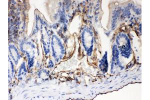 Anti- ABCB4 Picoband antibody, IHC(P) IHC(P): Mouse Intestine Tissue (ABCB4 antibody  (AA 601-720))