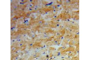 Used in DAB staining on fromalin fixed paraffin-embedded Heart tissue (Angiopoietin 2 antibody  (AA 269-496))