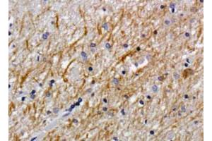 Immunohistochemistry staining of CSPG4 in human brain using DAB with hematoxylin counterstain