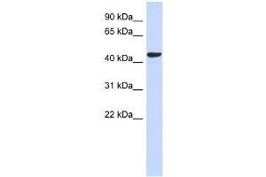 SGMS2 antibody used at 1 ug/ml to detect target protein. (Sphingomyelin Synthase 2 antibody  (N-Term))