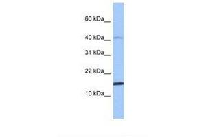 Image no. 1 for anti-Sperm Associated Antigen 11B (SPAG11B) (N-Term) antibody (ABIN6738889) (SPAG11B antibody  (N-Term))