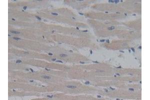 Immunohistochemistry (IHC) image for anti-Fibromodulin (FMOD) (AA 19-376) antibody (ABIN7433696)